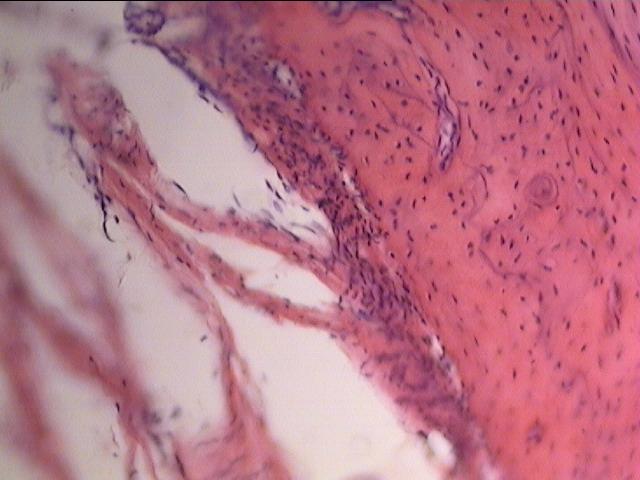Рис. 1. Микроскопическое строение костной ткани нижней челюсти на 180 сутки эксперимента подопытного животного с диаметром исходного имплантационного ложа 3,5 мм (окраска гематоксилин - эозином. Увеличение х 200).
