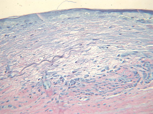 Рис. 6. Пролиферативная стадия воспаления - усиливается пролиферация фибробластных клеток с формированием новой рыхлой соединительной ткани. Ув. x600.