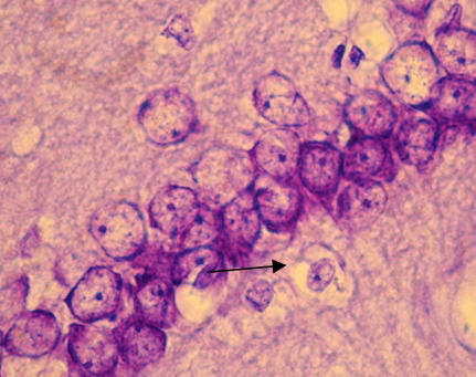Рис. 1. СА1 регион гиппокампа крысы OXYS – интактные (стрелкой указан нейрон с тотальным хроматолизом). Окраска крезиловым фиолетовым по Нисслю. Об. 100, ок. 10.