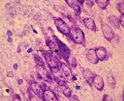 Рис. 2. СА1 регион гиппокампа крысы OXYS– интактные (стрелкой указан гиперхромный нейрон без сморщивания). Окраска крезиловым фиолетовым по Нисслю. Об. 100, ок. 10.