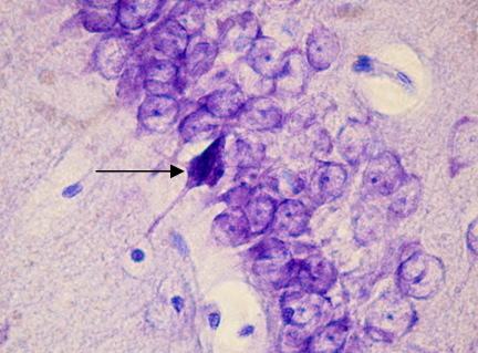 Рис. 3. СА1 регион гиппокампа крысы OXYS– интактные (стрелкой указан гиперхромный сморщенный нейрон). Окраска крезиловым фиолетовым по Нисслю. Об. 100, ок. 10.