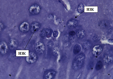 Рис. 3. Наружный зернистый слой коры больших полушарий. Стрелкой обозначены нейроны наружного зернистого слоя (НЗК). Окраска гематоксилином и эозином. Ув. 100×10.