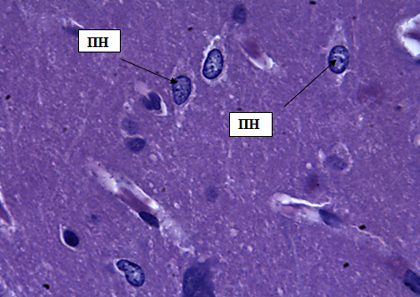 Рис. 4. Наружный пирамидный слой коры больших полушарий. Стрелками обозначены пирамидные нейроны (ПН). Окраска гематоксилином и эозином. Ув. 100×10.