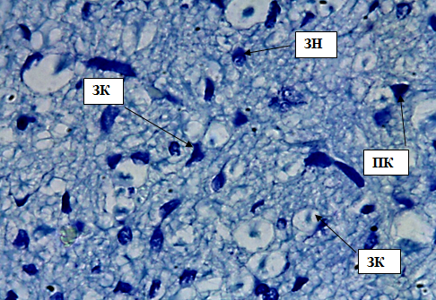 Рис. 5. Внутренний зернистый слой коры больших полушарий. Стрелкой обозначены звездчатые клетки (ЗК), пирамидные клетки (ПК), зернистые нейроны (ЗН). Окраска метиленовым синим по Нисслю. Ув. 100×10.