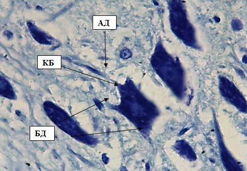 Рис. 6. Внутренний пирамидный слой коры больших полушарий. Стрелками обозначены: клетки Беца (КБ), апикальный дендрит (АД), боковые дендриты (БД). Окраска метиленовым синим по Нисслю. Ув. 100×10.