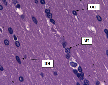 Рис. 8. Полиморфный слои коры больших полушарий. Стрелками обозначены: пирамидные нейроны (ПН), зернистые нейроны (ЗН), овальные нейроны (ОН). Окраска гематоксилином и эозином. Ув. 40×10.