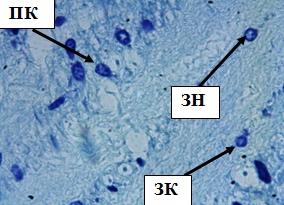 Рис. 9. Внутренний зернистый слой коры больших полушарий при воздействии свинца. Стрелкой обозначены звездчатые клетки (ЗК), пирамидные клетки (ПК), зернистые нейроны (ЗН). Окраска метиленовым синим по Нисслю. Ув. 100×10.
