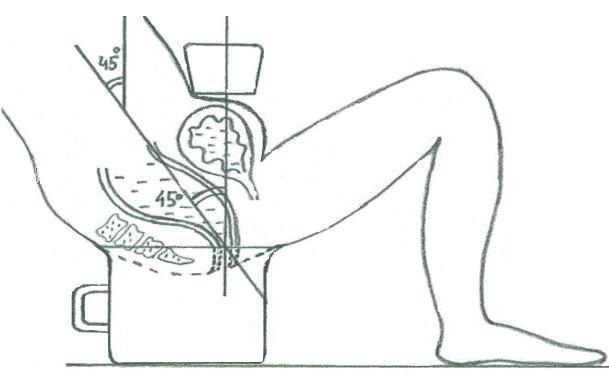 Рис. 3. Схема ультразвуковой видеодефекоскопии.