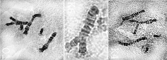 Рис. 3. Изменение структуры политенных хромосом в слюнных железах Chironomus plumosus при действии метиленового синего в концентрации 1,0 мг/л (рисунка увеличенная хромосома с асинапсом).