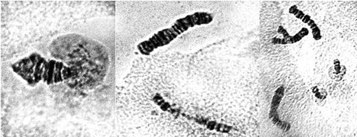 Рис. 4. Аберрации в политенных хромосомах слюнных желез хирономид под действием растворов профлавина в концентрациях 1.0 мг/л (верхний ряд снимков) и 0,5 мг/л (нижний ряд снимков). Слева фрагмент разошедшейся 4-й телоцентрической хромосомы под влиянием профлавина с увеличением колец Бальбиани.