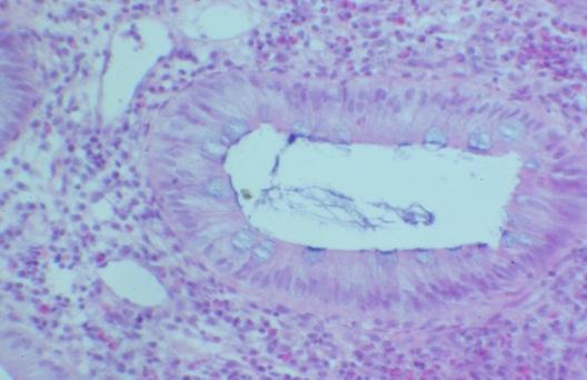 Рис. 8. Микрофотография. Бокаловидные клетки эпителия слизистой оболочки толстой кишки. Об. 20., ок. 15. Окраска гематоксилин – эозин.