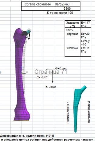Рис.1. Математическое моделирование напряженно-деформированного состояния биомеханической системы «бедренная кость-ножка эндопротеза проксимальной фиксации «CORAIL» - а и «TAPERLOCK» - b.