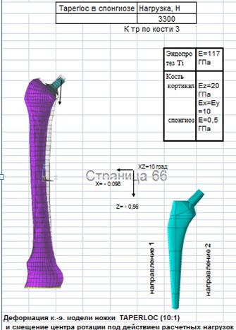 Рис.1. Математическое моделирование напряженно-деформированного состояния биомеханической системы «бедренная кость-ножка эндопротеза проксимальной фиксации «CORAIL» - а и «TAPERLOCK» - b.