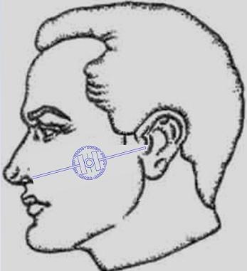 Рис.3 Схема расположения устройства для определения индивидуальной носоушной линии на лице пациента.