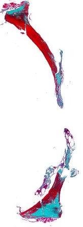 Рис.1. Гистотопограмма теменной кости крысы через 30 дней после нанесения повреждения. Окраска по Массон-Голнер. Х32