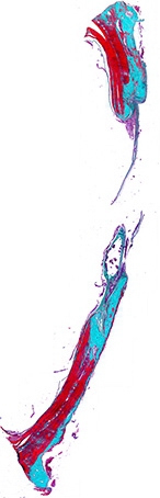 Рис. 2. Гистотопограмма поперечного среза теменной кости крысы через 60 дней после нанесения повреждения. Окраска по Массон-Голдер. Х32