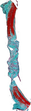 Рис. 5а. Костный регенерат через 60 дней после имплантации остеопластического материала. Гранулы материала заполняют центральную часть дефекта в окружении соединительной ткани. Окраска по Массон-Голднер. Х32