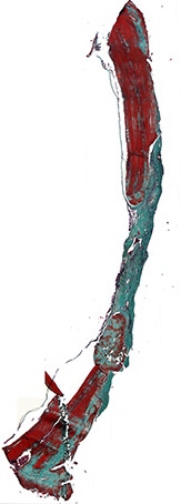 Рис. 8а. Костный регенерат через 60 дней после имплантации остеопластического материала содержащего костный морфогенетический белок. Отмечается аппозиционный рост костной ткани со стороны материнского ложа. Окраска по Массон-Голднер. Х32