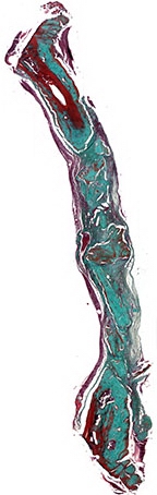 Рис. 9а. Зрелый костный регенерат через 90 дней после имплантации остеопластического материала содержащего костный морфогенетический белок. В центральной части дефекта гранулы материала в окружении соединительной ткани. Окраска по Массон-Голнер. Х32