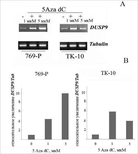 Рис. 1. Анализ влияния 5-азадезоксицитидина на транскрипцию гена DUSP9 в клеточных линиях карциномы почки человека: А – результат электрофореза продуктов амплификации в клеточных линиях TK-10 и 769-P до и после воздействия в течение 72 часов 5- Aza dC в разных концентрациях; В – денситометрическая оценка относительного изменения уровней мРНК DUSP9 в клетках под воздействием 5Aza dC, нормированных по tubulin