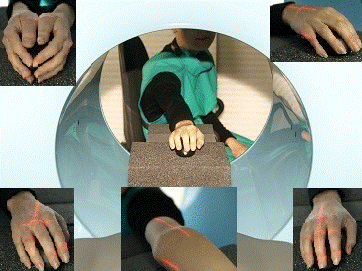 Рис. 1а. Укладка конечности для проведения КЛКТ кисти, лучезапястного и локтевого сустава