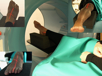 Рис. 1б. Укладка конечности для проведения КЛКТ стопы, голеностопного и коленного сустава