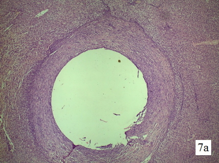 Рис. 7а. Гистологическая структура парадренажной зоны печени крысы на 10-е сутки. Обзорная микрофотография, увеличение 1х60, окраска гематоксилин+эозин. Стенка свищевого хода представлена зрелой плотной соединительной тканью.