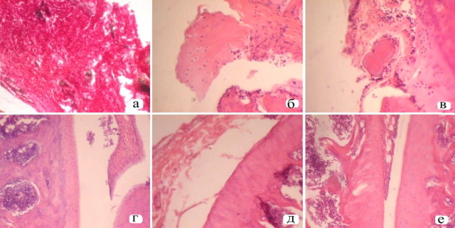Рис. 1. а - морфоструктура коленного сустава крыс с КИА на 28 сутки исследования. Гиперплазированная плотная синовиальная оболочка; б - бесструктурные, набухшие, разрушенные участки суставного хряща; в - бесструктурные, набухшие, разрушенные участки суставного хряща, окрас изменен, видны редкие лейкоциты; г - морфоструктура коленного сустава под влиянием 1 - БИСГ на 28 сутки эксперимента. Нормальное строение суставного хряща и синовиальной оболочки; д - морфоструктура коленного сустава крыс с КИА под влиянием натрия диклофенака состоянию на 28 сутки эксперимента. Изменены синовиальная оболочка и суставной хрящ. е - Узкий паннус, что наползает на боковую поверхность хряща. Сб. 200.