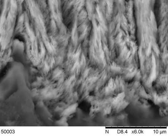 Рис. 4. Фото с электронного сканирующего микроскопа HITACHI. Граница дентин – пульпа при увеличении 6000 х и ускоряющем напряжении 15 кВ. Видны кристаллы гидроксиапатита