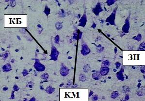 Рис. 10. Внутренний пирамидный слой коры больших полушарий. Стрелками обозначены: клетки Беца (КБ), клетки Мейнерта (КМ), звездчатые нейроны (ЗН). Окраска метиленовым синим по Нисслю. Ув. 40×10.