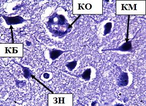 Рис. 11. Внутренний пирамидный слой коры больших полушарий при воздействии свинца. Стрелками обозначены: клетки Беца (КБ), клетки Мейнерта (КМ), звездчатые нейроны (ЗН), кистозное образование (КО) Окраска метиленовым синим по Нисслю. Ув. 100×10.