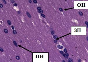 Рис. 12. Полиморфный слои коры больших полушарий. Стрелками обозначены: пирамидные нейроны (ПН), зернистые нейроны (ЗН), овальные нейроны (ОН). Окраска гематоксилином и эозином. Ув. 40×10.