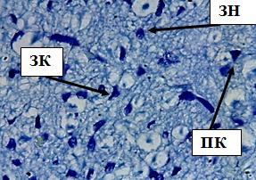Рис. 8. Внутренний зернистый слой коры больших полушарий. Стрелкой обозначены звездчатые клетки (ЗК), пирамидные клетки (ПК), зернистые нейроны (ЗН). Окраска метиленовым синим по Нисслю. Ув. 100×10.