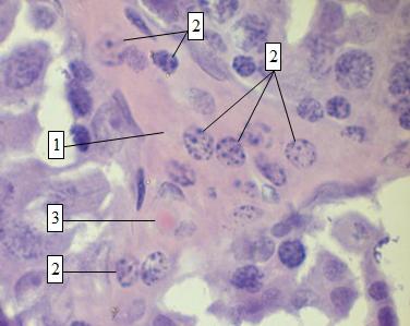 Рис. 4. Интерстициальная ткань семенных желез. Окраска гематоксилин-эозин. Об. 100 × ок. 10: 1 - участок интерстиция; 2 - клетки Лейдига; 3 - кровеносный сосуд.