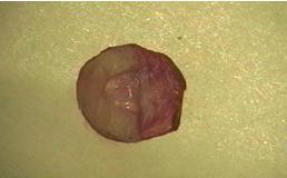 Рис. 1. Хондро-перихондриальный трансплантат с хрящевым компонентом подковообразной формы.