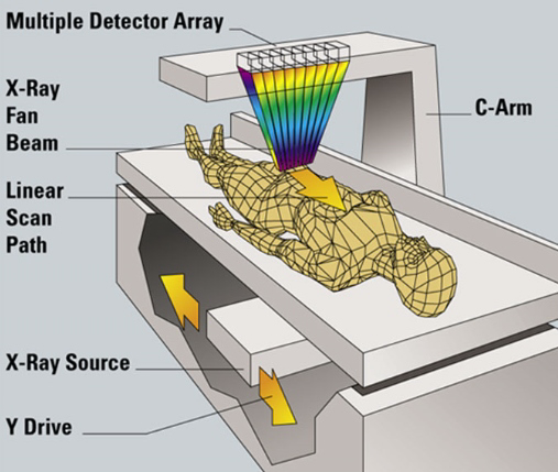 Рис. 1. Схематическое расположение излучателя и принимающего устройства в денситометре HOLOGIC Discovery SL.