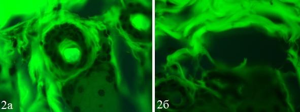 Рис. 2. Картина флуоресцентной микроскопии просветов сосудов и близлежащих клеток у крыс с раневым дефектом (а) и неповрежденной кожей (б). ×400.