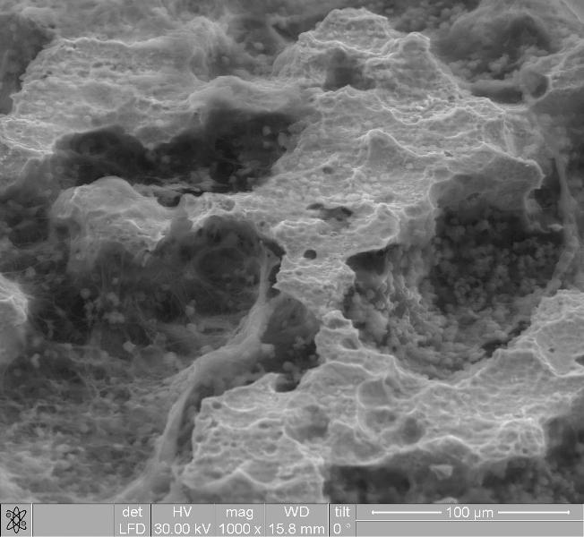 Рис. 1. Электронная микроскопия поверхности пластины при увеличении *1000 через 1 сут эксперимента. На поверхности и, особенно, в порах пластины, определяются рыхлые паутинообразные тяжи фибрина со склеенными эритроцитами.
